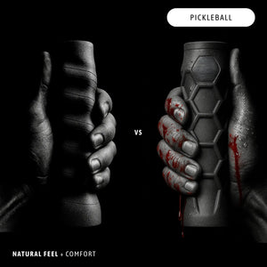 Two hands holding pickleball paddles with a dark background and 'Pickleball' text at the top.